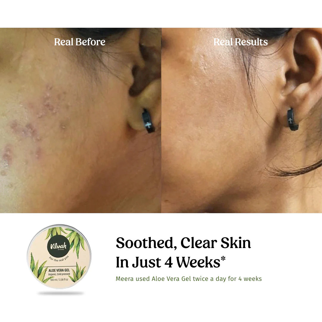 Aloe Vera Gel (Multi-Purpose Skin & Hair Care) - Image 3