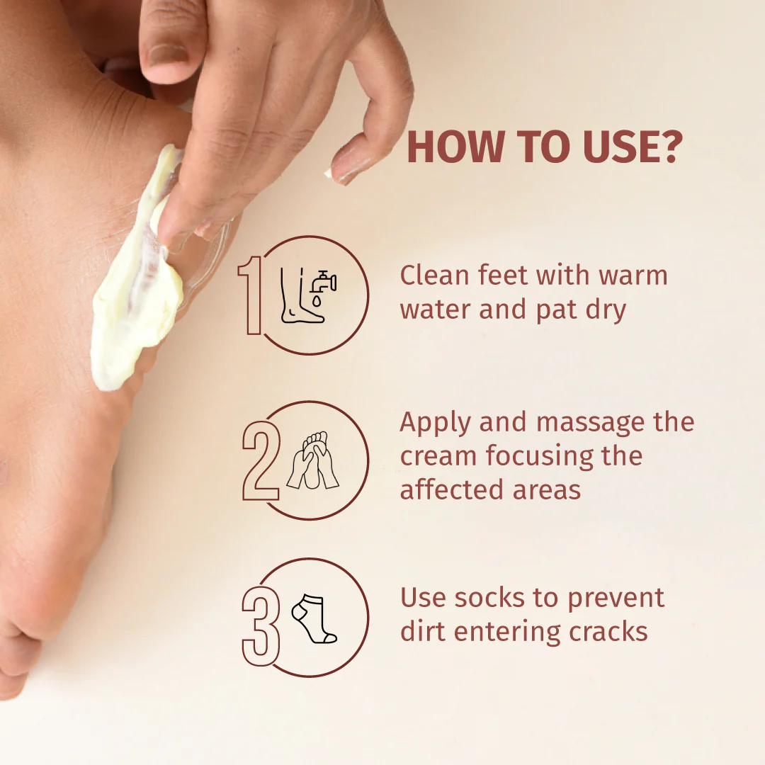 Foot Cream (Treats Cracked Heels) - Image 7