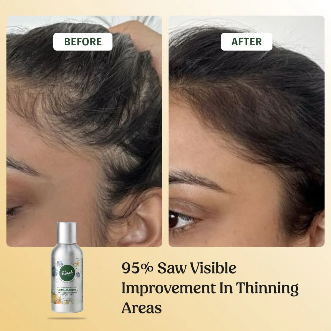 Hair Regrowth Oil - Image 3