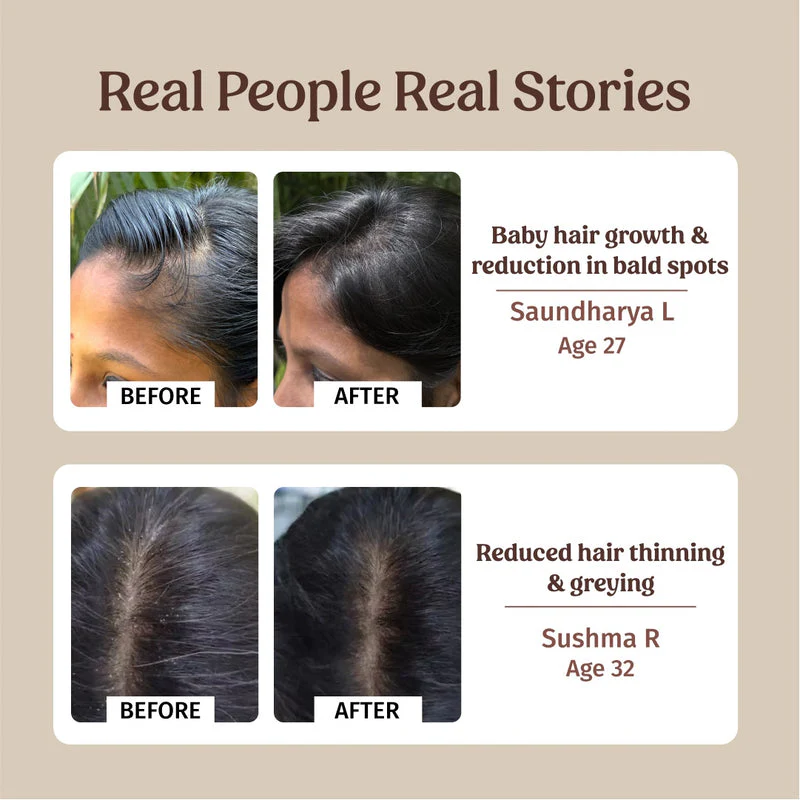 Hairfall Control Kit - Image 4