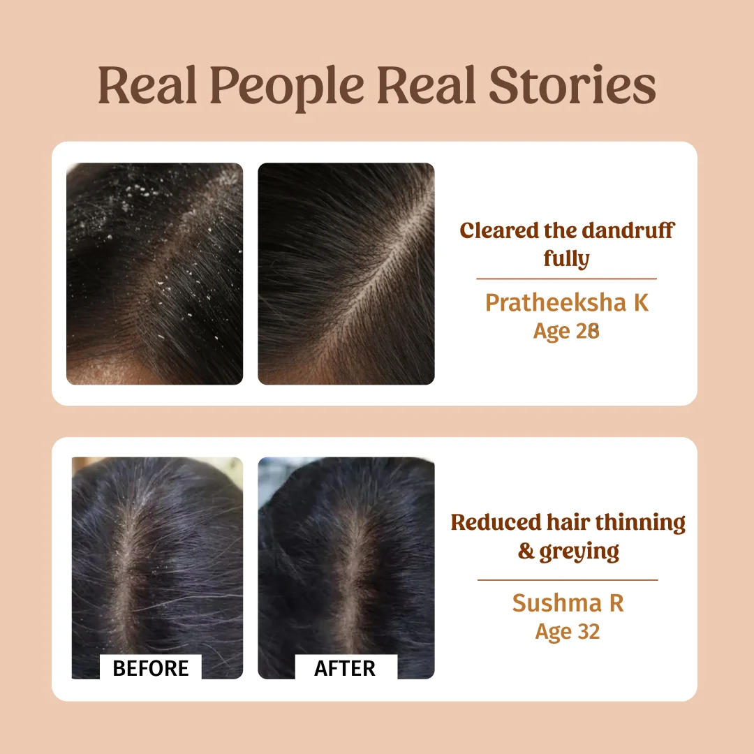 Herbal Shampoo 250ml (Dandruff Control) - Image 4