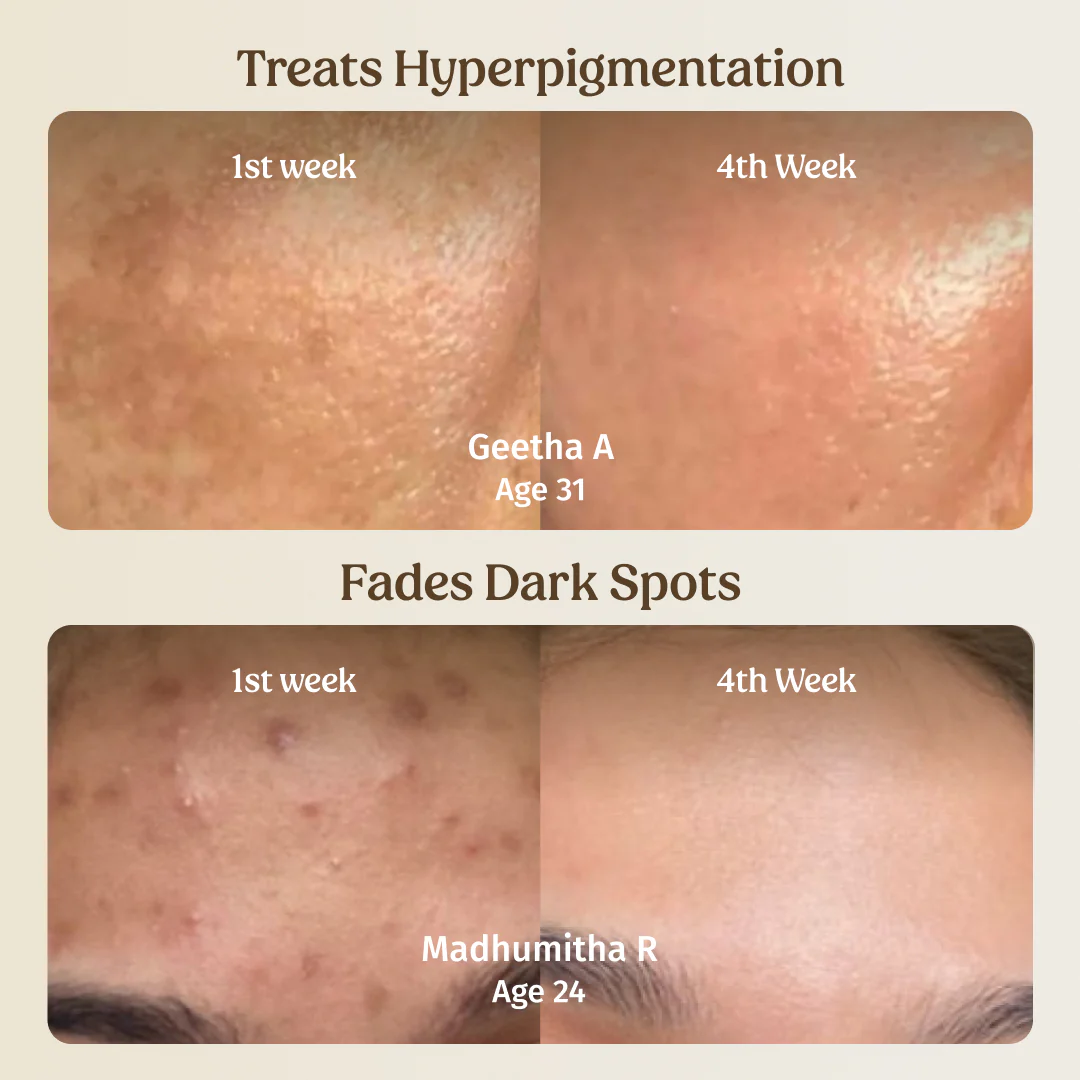 Milk Drops Brightening Serum 40ml - Image 3