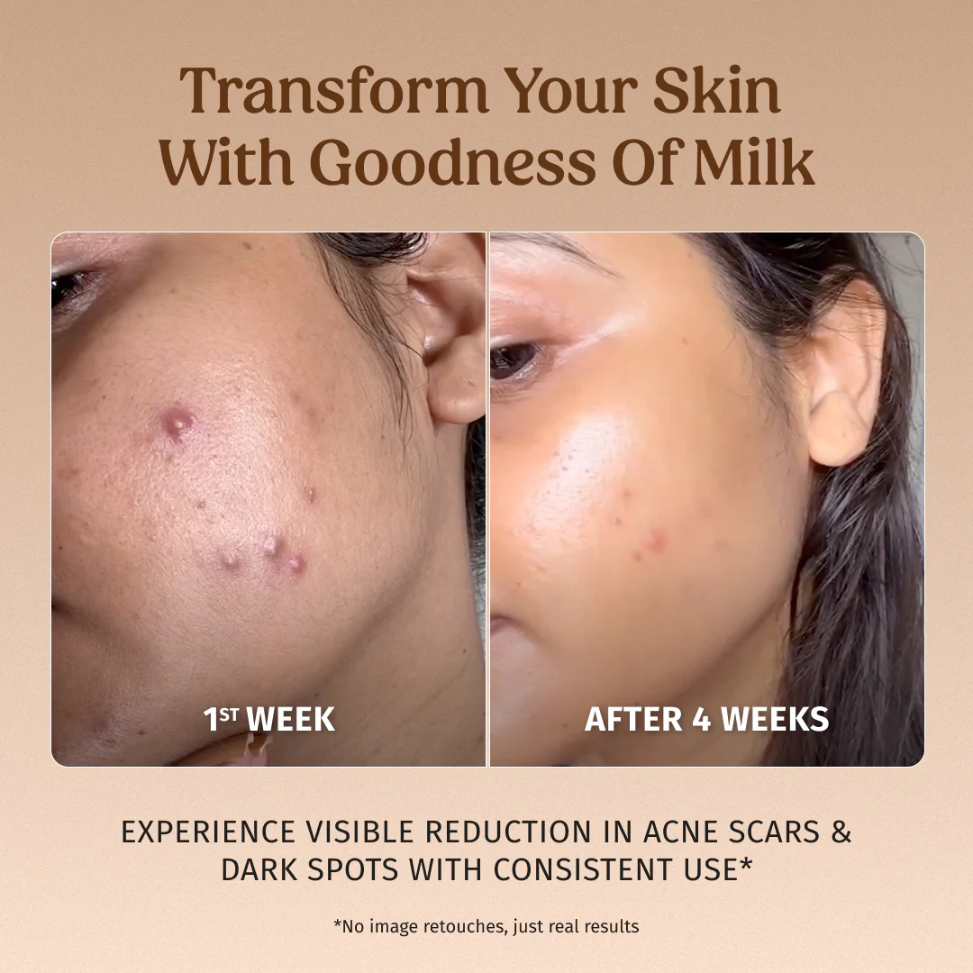Milk Drops Brightening Serum 40ml Pack of Two - Image 3