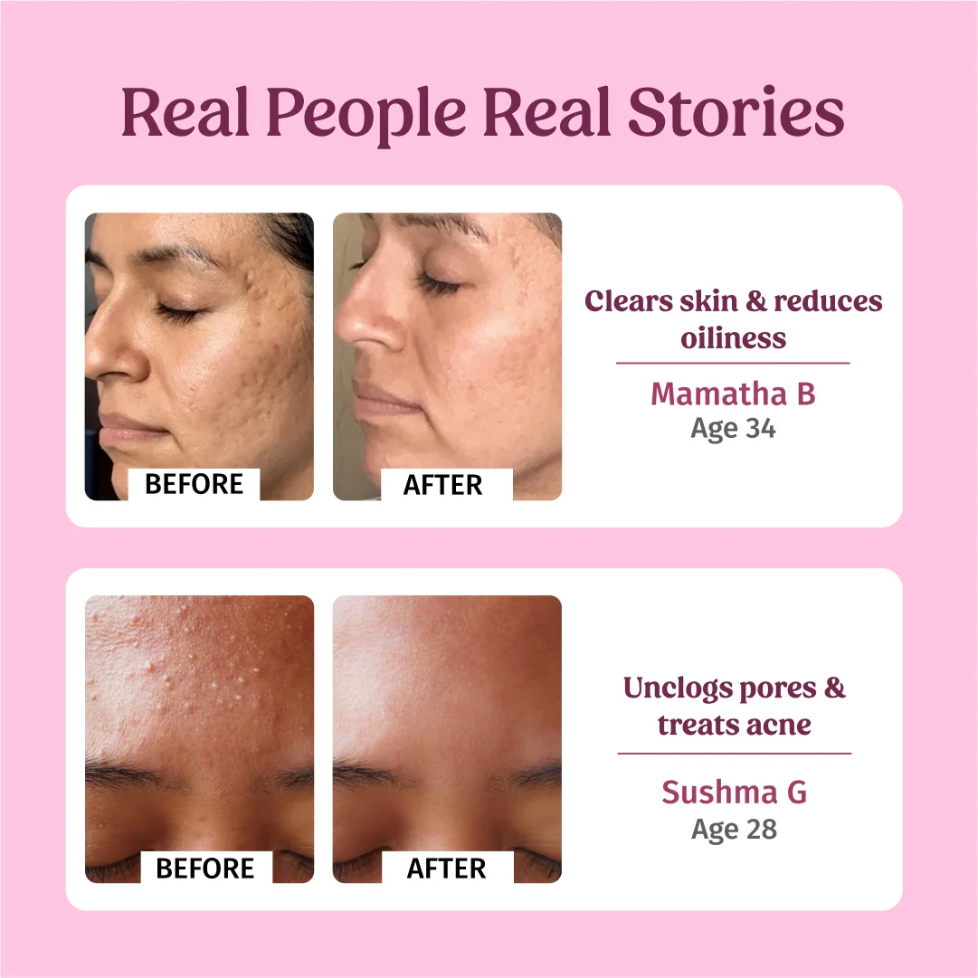 Rosewater Facial Toner (Hydration) - Image 6